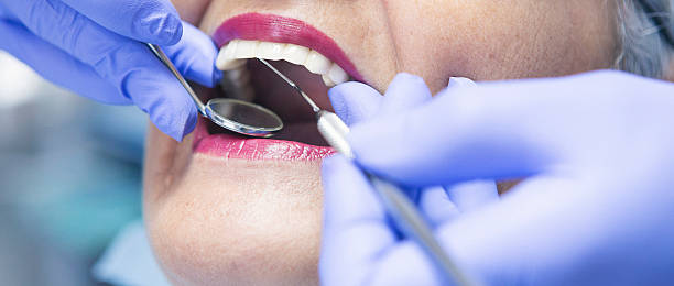 Best Emergency Wisdom Teeth Removal in Douglas, GA